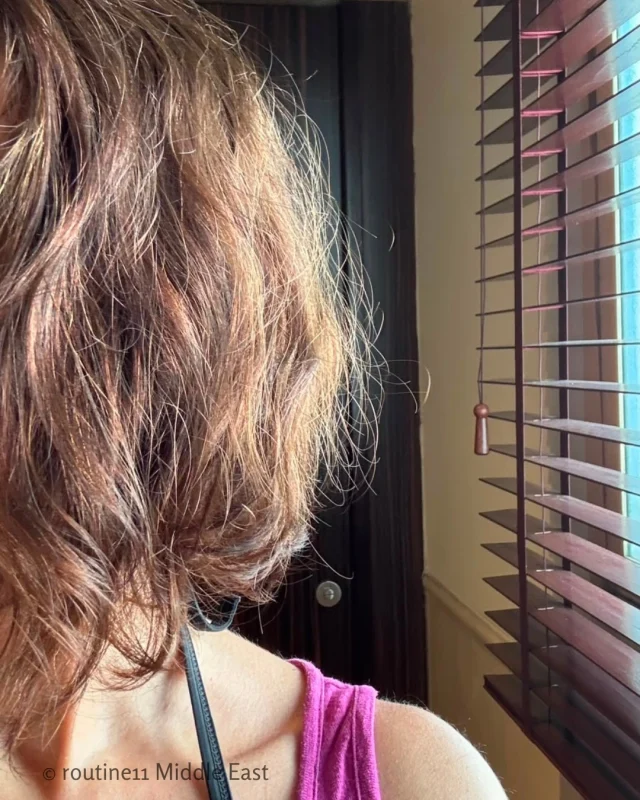 The Dubai Guide For Hair Loss